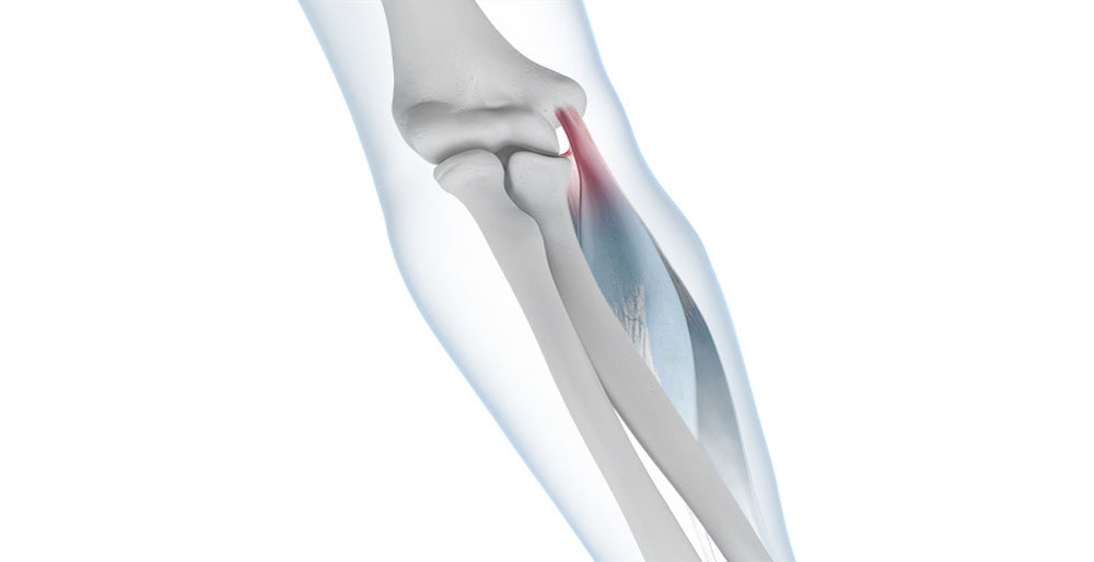 Golfer's Elbow