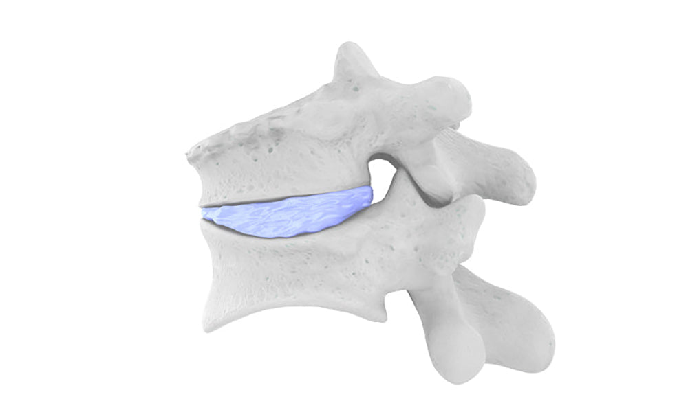 Vertebral Compression Fractures